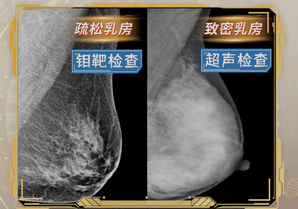 乳腺癌成全球第一大癌症如何远离粉红杀手